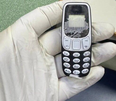 فريق طبي ينجح في استخراج هاتف محمول من بطن مريض ظل داخله 11 شهرا فريق طبي ينجح في استخراج هاتف محمول من بطن مريض ظل داخله 11 شهرا