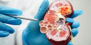 ارتفاع عالمي للإصابات بمرض قاتل يدخل ضمن أبرز 10 أسباب للوفيات - المصدر 24