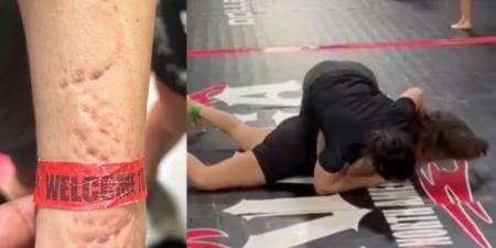 اعتداء وحشي.. لاعبة جوجتسو "تعض" منافستها خلال مباراة - المصدر 24