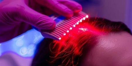 حلك السحري.. نتائج لاستخدام الضوء الأحمر ضد تساقط الشعر - المصدر 24