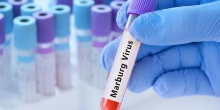 إثيوبيا تعلن تفشي وباء "ماربورغ" بالبلاد - المصدر 24