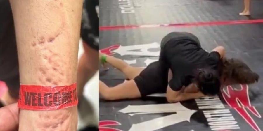 اعتداء وحشي.. لاعبة جوجتسو "تعض" منافستها خلال مباراة - المصدر 24